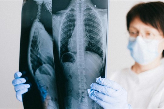 Radiologická ambulance v Kraslicích nezanikne: Získala dotaci od Karlovarského kraje